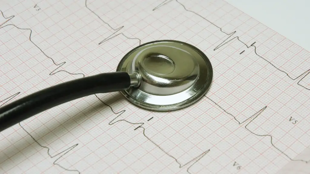 partiqlar - ECG printout with stethoscope